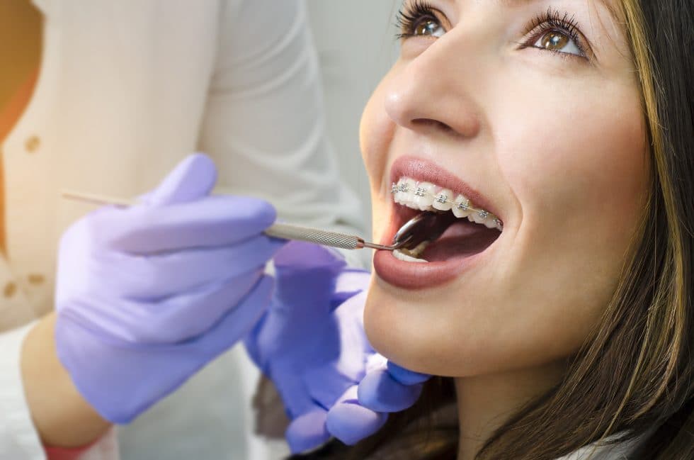 dental-cleaning-for-braces-dental-check-up-with-braces-mcallen-tx