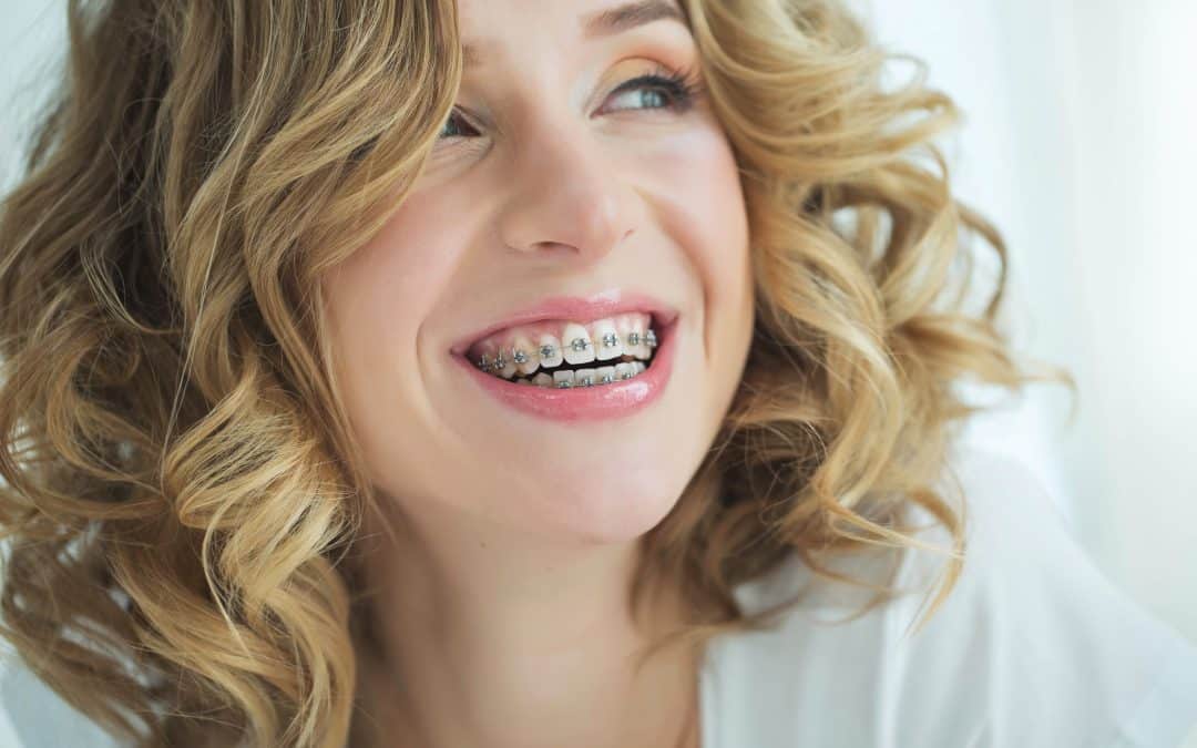 Orthodontic Treatment for Missing Teeth