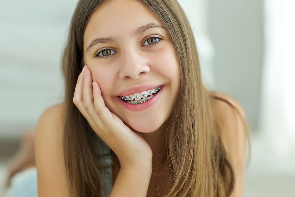 teen smiling with braces Senan Orthodontics Mcallen, tx
